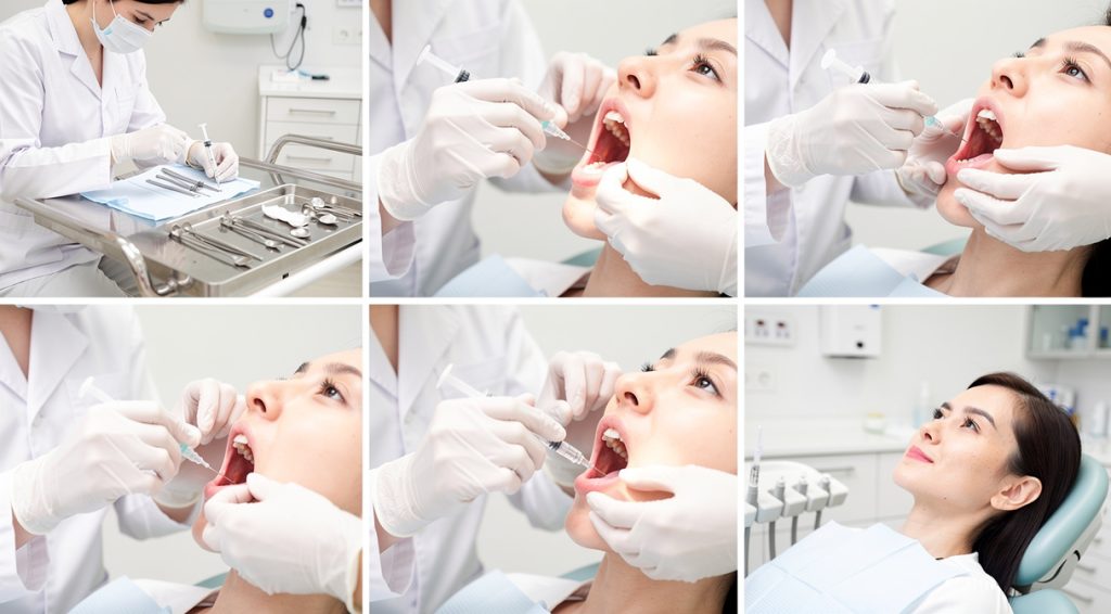 Comment faire partir une anesthésie dentaire