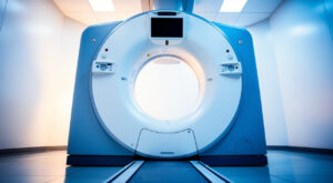 Cancer du poumon : Lyon lance le programme pilote IMPULSION dès le 11 mai 2026