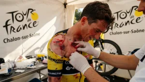 Jenno Berckmoes fracturé : Lotto-Intermarché perd un deuxième coureur sur le Tour